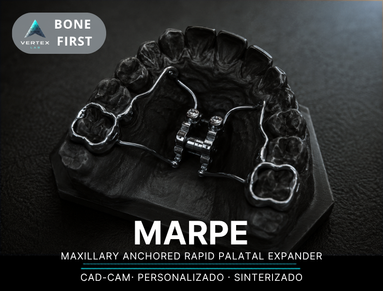 Expansor MARPE personalizado