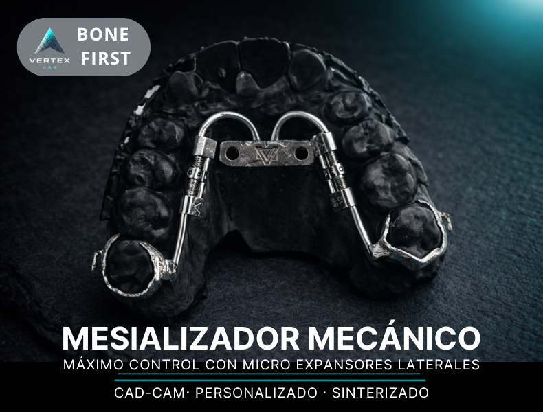 Mesializador metálico sobre anclajes